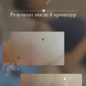 студия эпиляции laser ultimate изображение 12 на проекте moiaeroport.ru