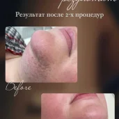 студия эпиляции laser ultimate изображение 2 на проекте moiaeroport.ru