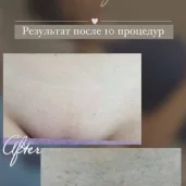 студия эпиляции laser ultimate изображение 5 на проекте moiaeroport.ru