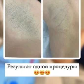 студия эпиляции laser ultimate изображение 11 на проекте moiaeroport.ru