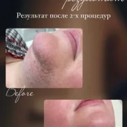 студия эпиляции laser ultimate изображение 2 на проекте moiaeroport.ru